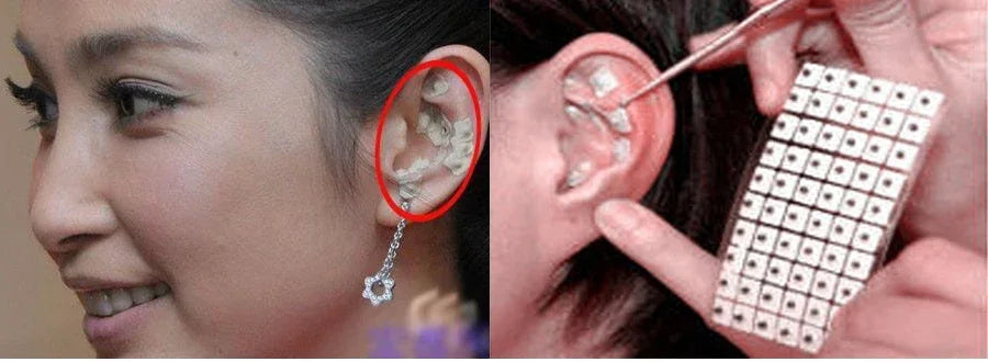 6000pcs Auriculotherapy Ear Seeds Stickers with Probe Tools 10 Packs Acupressure Relief Vaccaria Seeds Spring Massage Probe Kit