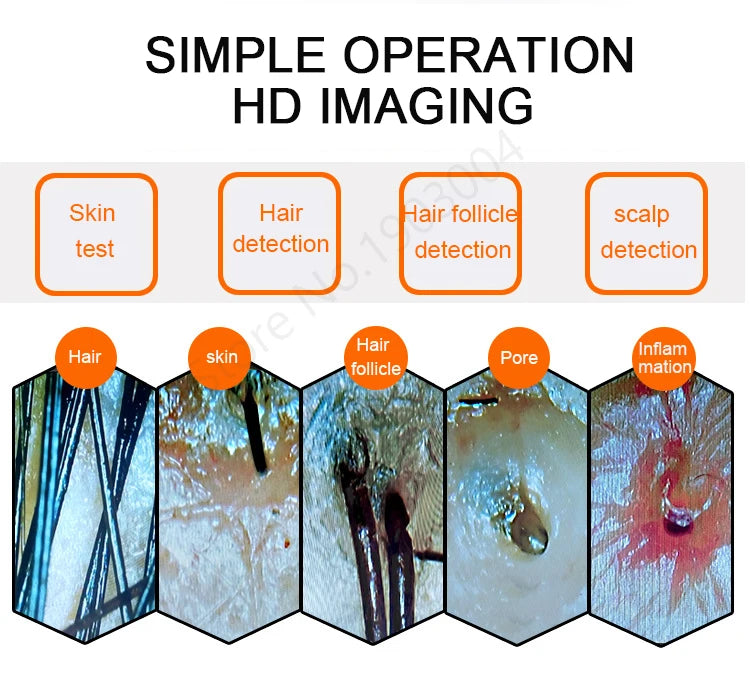 Scalp & Facial Skin Analyzer Machine 200x HD Digital Dermoscopy for Hair Follicle Diagnosis and Skin Health Detection