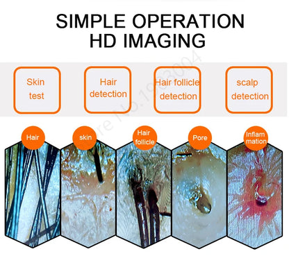 Scalp & Facial Skin Analyzer Machine 200x HD Digital Dermoscopy for Hair Follicle Diagnosis and Skin Health Detection