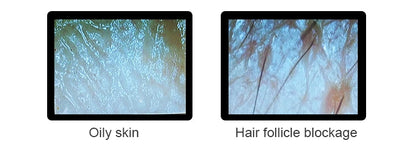 Scalp & Facial Skin Analyzer Machine 200x HD Digital Dermoscopy for Hair Follicle Diagnosis and Skin Health Detection