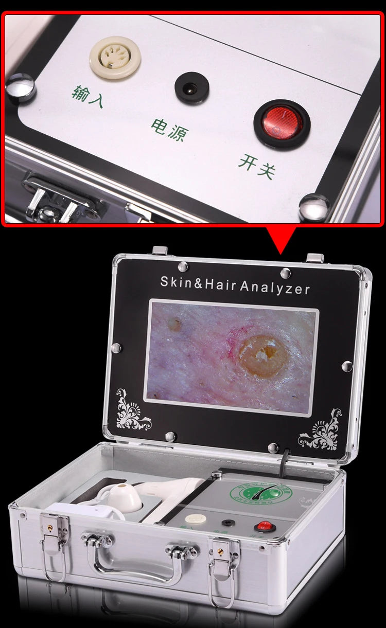 Scalp & Facial Skin Analyzer Machine 200x HD Digital Dermoscopy for Hair Follicle Diagnosis and Skin Health Detection