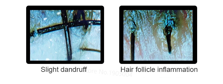 Scalp & Facial Skin Analyzer Machine 200x HD Digital Dermoscopy for Hair Follicle Diagnosis and Skin Health Detection