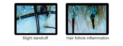Scalp & Facial Skin Analyzer Machine 200x HD Digital Dermoscopy for Hair Follicle Diagnosis and Skin Health Detection