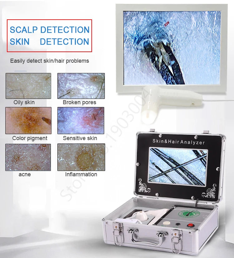 Scalp & Facial Skin Analyzer Machine 200x HD Digital Dermoscopy for Hair Follicle Diagnosis and Skin Health Detection