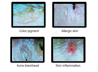 Scalp & Facial Skin Analyzer Machine 200x HD Digital Dermoscopy for Hair Follicle Diagnosis and Skin Health Detection