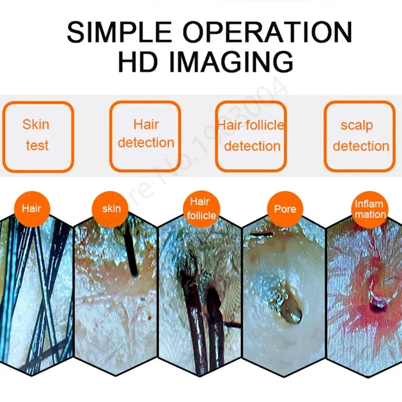 Scalp & Facial Skin Analyzer Machine 200x HD Digital Dermoscopy for Hair Follicle Diagnosis and Skin Health Detection